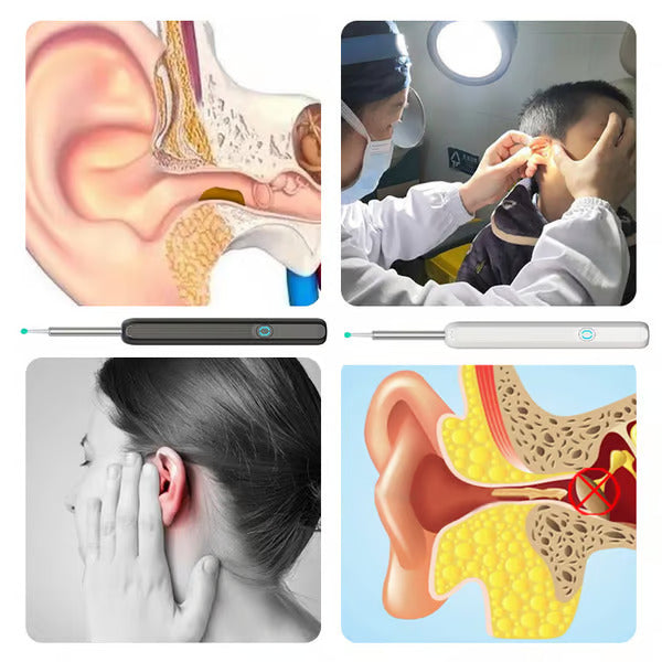 Easy Ear Cleaner Set with Camera
